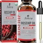 Beneficios de la rosa mosqueta en productos de parafarmacia: ¿Por qué es tan bueno para la piel?